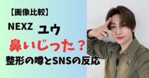 画像比較nexzユウの鼻は整形か噂の真相とsnsの反応