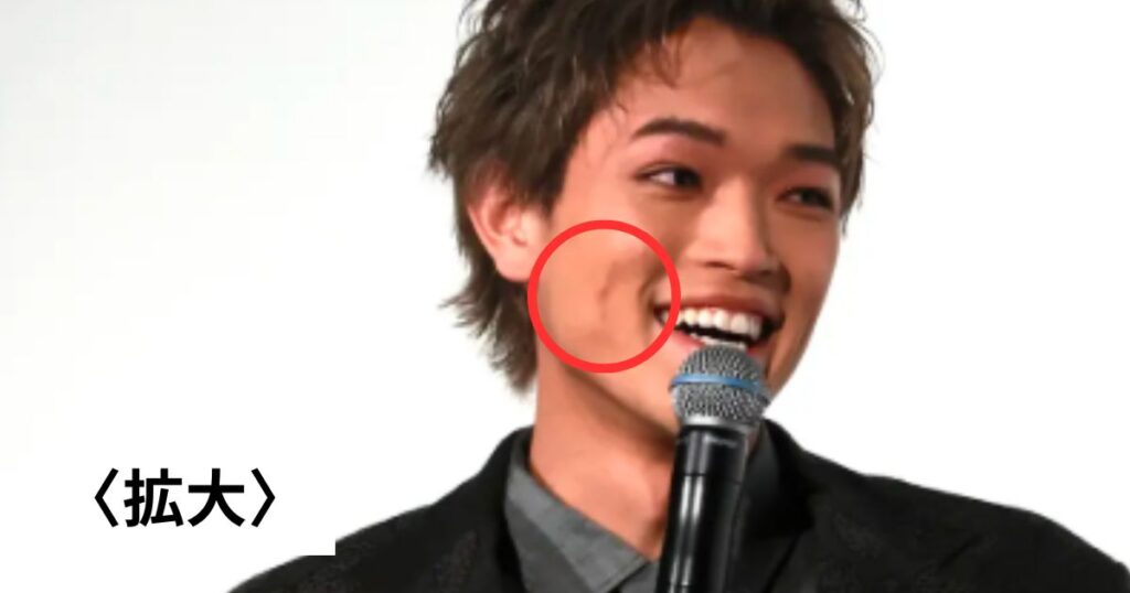 Timeleszの原嘉孝のほくろいつ取った？メイクで隠したのか整形なのか画像比較で調査